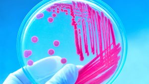 Antibiotic test paper